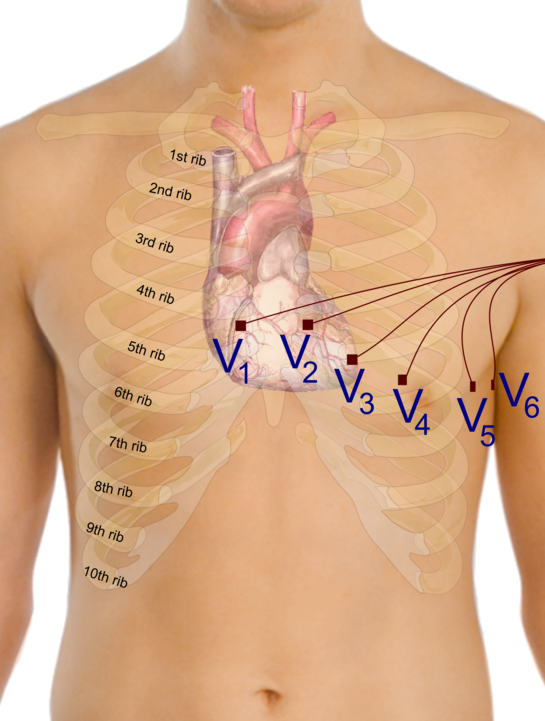 545px Precordial leads in ECG