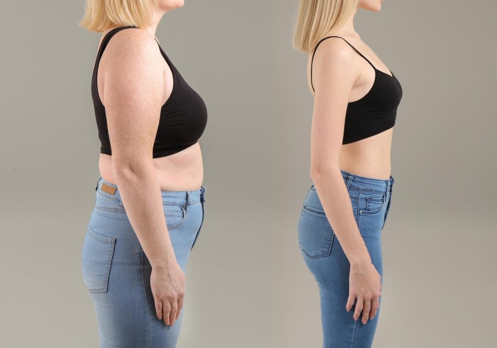 semaglutide weight loss teleconsultation image