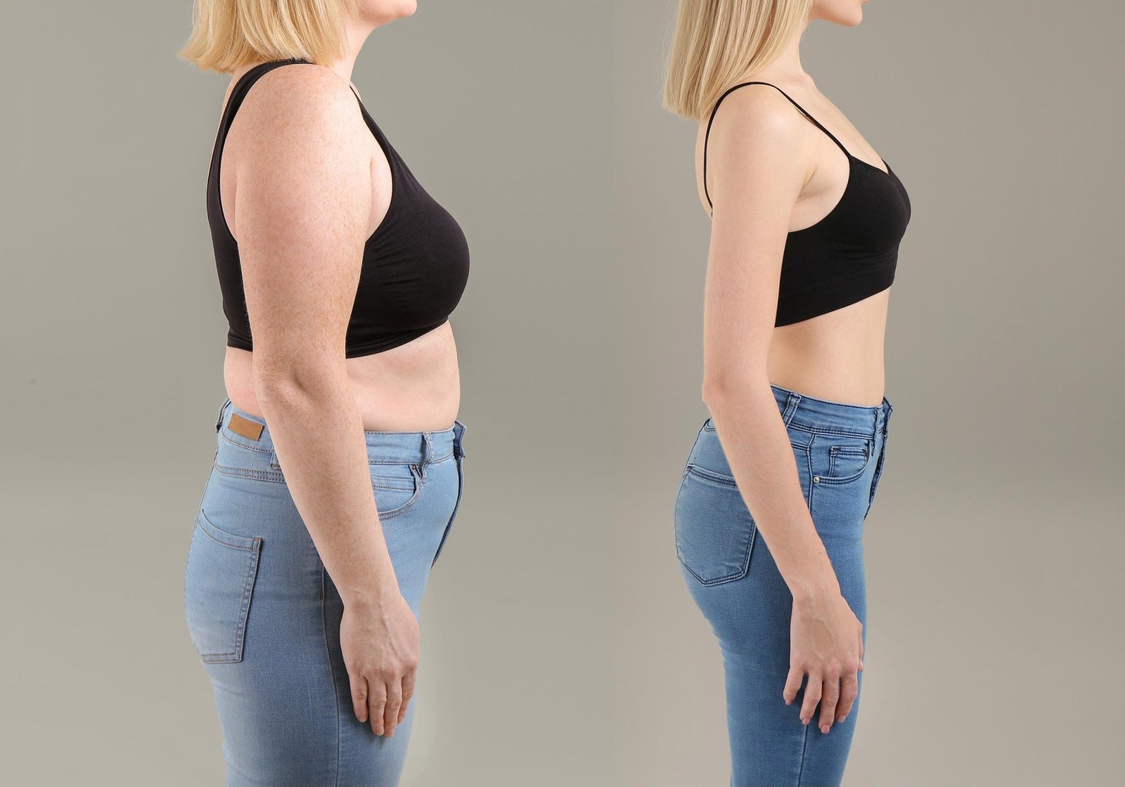 semaglutide weight loss teleconsultation image